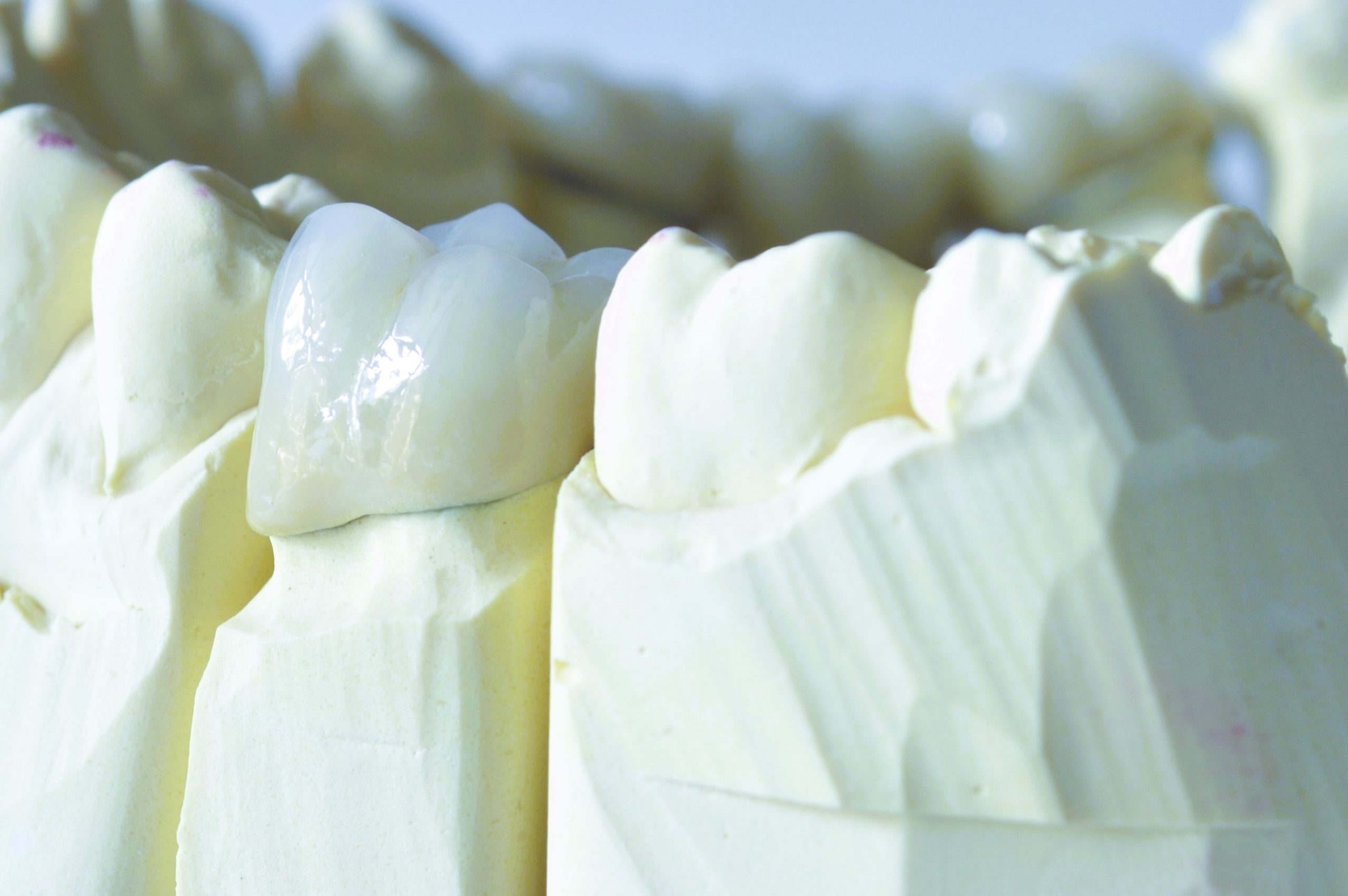 zirconia dental crown close-up before and after